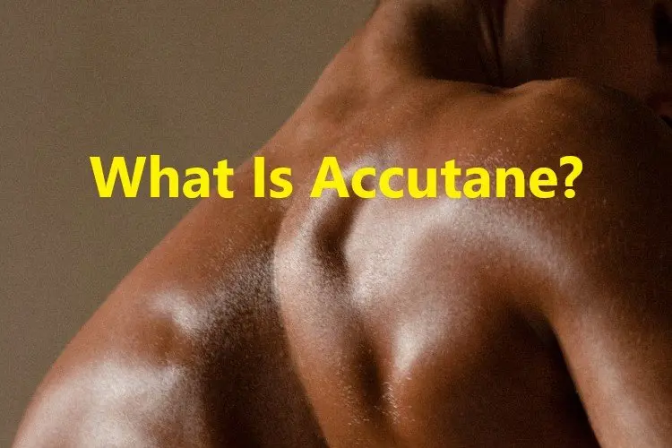 What Is Accutane? What Is Accutane?